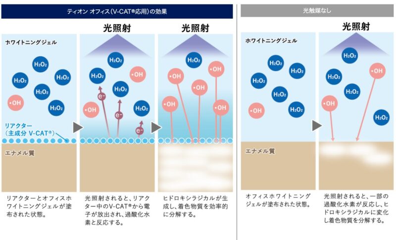 TiONオフィス ホワイトニングシステム