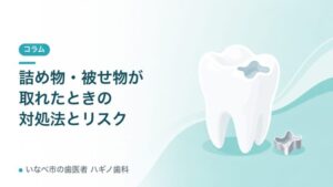 詰め物・被せ物が取れたときの対処法と放置するリスク（記事アイキャッチ）